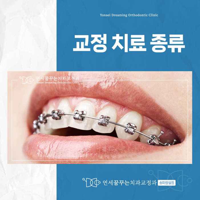 송파구치과 내 치아에 맞는 교정법은? 종류별 특징 정리